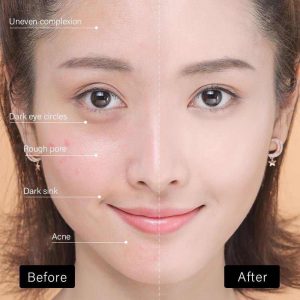 ژل آبرسان آلوورا ژل آبرسان آلوورا